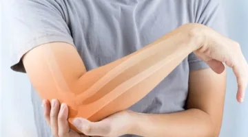 علامات نقص الكالسيوم ووسائل العلاج المتاحة لها