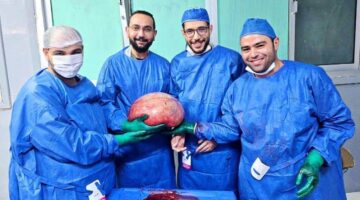 عاجل.. إزالة ورم يزن 15 كيلو من بطن فتاة عازبة في الفيوم