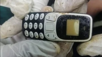 «بلع هاتفه قبل عامين».. عملية استخرجت جهاز موبايل من معدة مريض في أسيوط