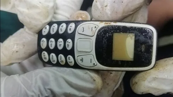 «بلع هاتفه قبل عامين».. عملية استخرجت جهاز موبايل من معدة مريض في أسيوط «بلع هاتفه قبل عامين».. عملية استخرجت جهاز موبايل من معدة مريض في أسيوط