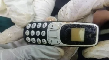 انتشال هاتف محمول من معدة شاب بعد عامين من بلعه