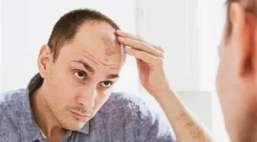 وداعًا لتساقط الشعر: علاج مبتكر للصلع يعتمد على الخلايا الجذعية