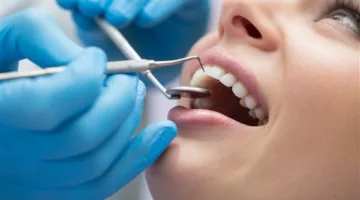 أساليب للحفاظ على صحة الأسنان بدون الحاجة للأدوية