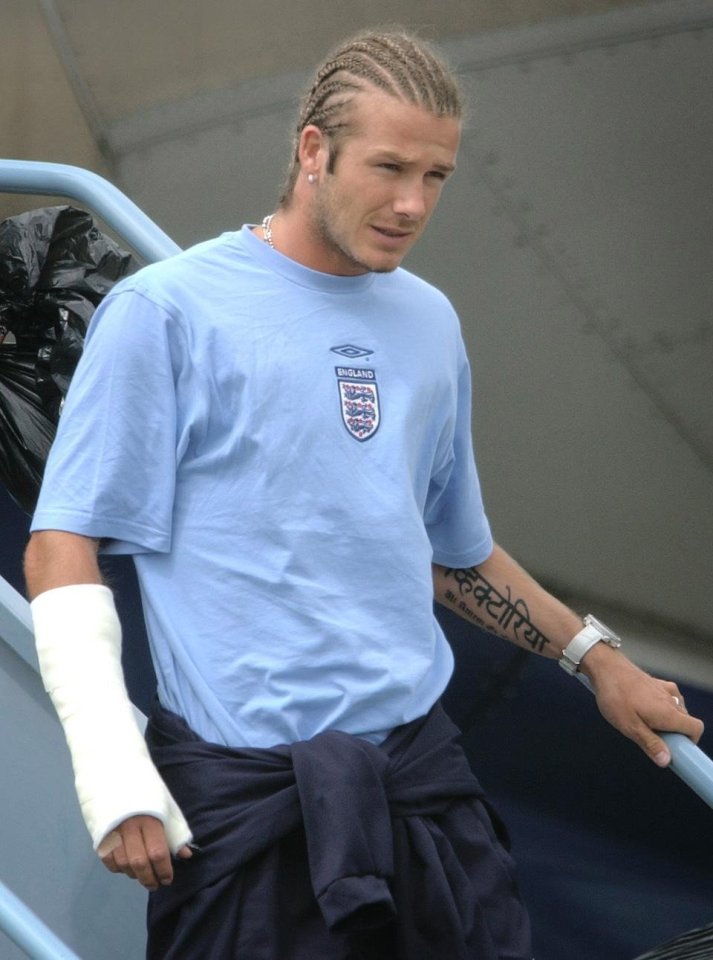 David Beckham with a cast on his arm.