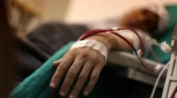 تفاصيل إنقاذ طفل يعاني من فشل كلوي في مستشفى العامرية بالإسكندرية