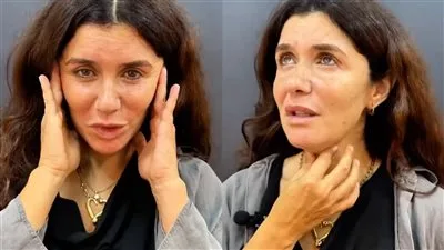 غادة عادل في إحدى عيادات التجميل: ليس قصدي أن أبدو أصغر، لكن لدي مشاكل تزعجني.