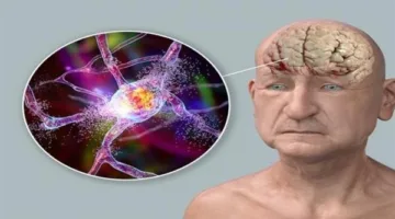 اكتشاف وسيلة فعّالة لتقليل شيخوخة الدماغ