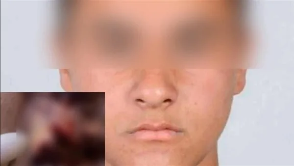 سائق أوبر يعتدي على شاب في المعادي ويخدش وجهه بـ 64 غرزة (فيديو) سائق أوبر يعتدي على شاب في المعادي ويخدش وجهه بـ 64 غرزة (فيديو)