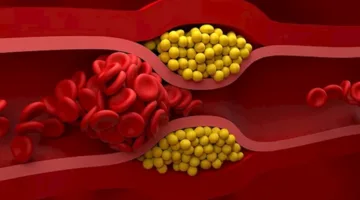 5 أطعمة تقلل الكوليسترول وتحافظ على صحة الشرايين