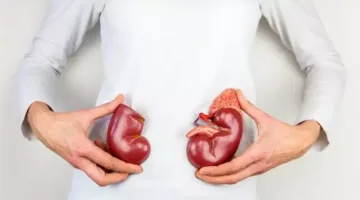 5 أكلات تؤدي إلى الفشل الكلوي وتضر صحتك.. يجب تجنبها فورًا