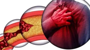 دراسة جديدة تكشف: الروائح غير المألوفة قد تشير إلى ارتفاع مستويات الكوليسترول