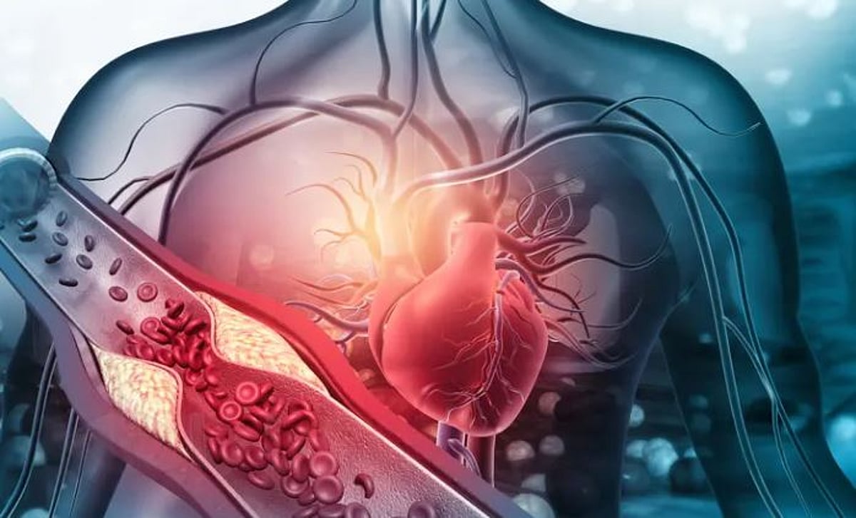 7 عوامل شائعة تعزز من احتمال حدوث نوبات قلبية صامتة.. ما هي؟