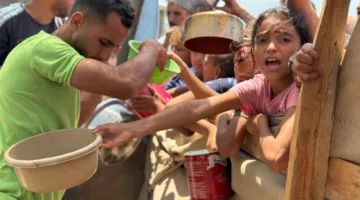 70 ألف طفل في غزة يعانون من درجات خطيرة من نقص التغذية