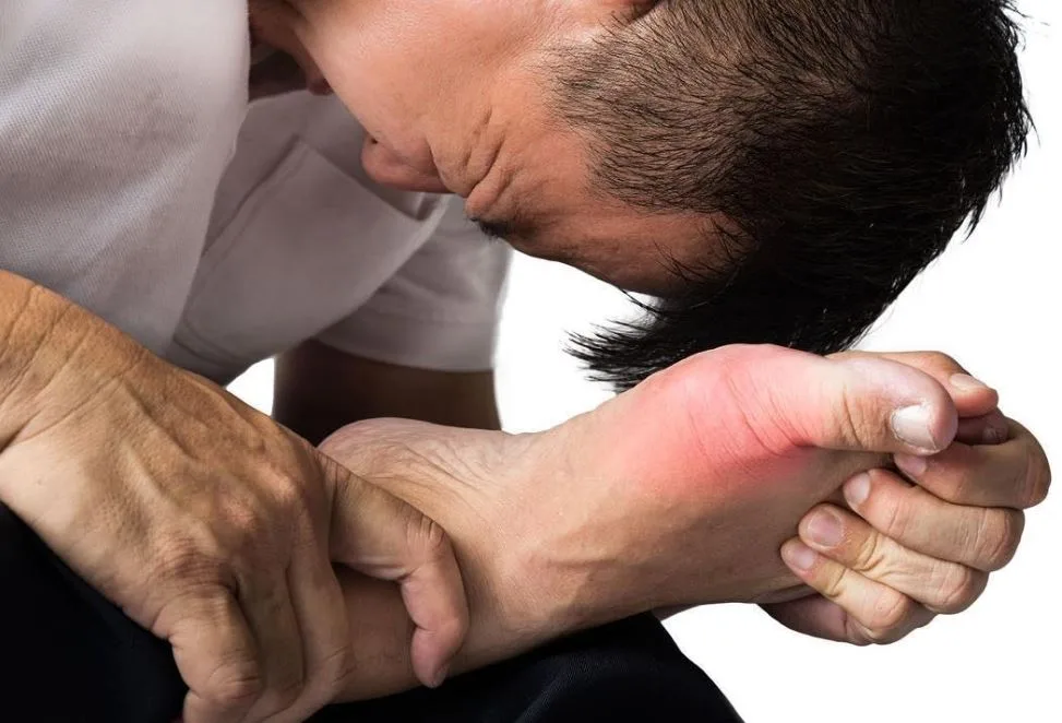 بعد عيد الأضحى: كيف تتجنب آلام النقرس؟