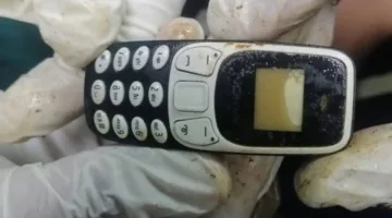 إخراج هاتف محمول من بطن مريض في مستشفى الأزهر الجامعي بأسيوط