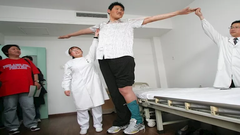 أسباب تؤثر على النمو البشري، بما في ذلك الطول أسباب تؤثر على النمو البشري، بما في ذلك الطول