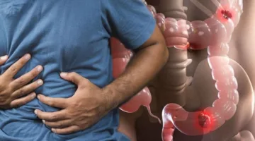 أطعمة تحتوي على الألياف والماء والنشاط: ثلاثة عناصر للوقاية من الإمساك