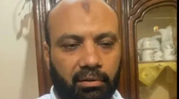 إزالة الطحال وبدء التنفس الاصطناعي: أحدث المستجدات حول صحة الناجيات من الحادث الإقليمي (فيديو)