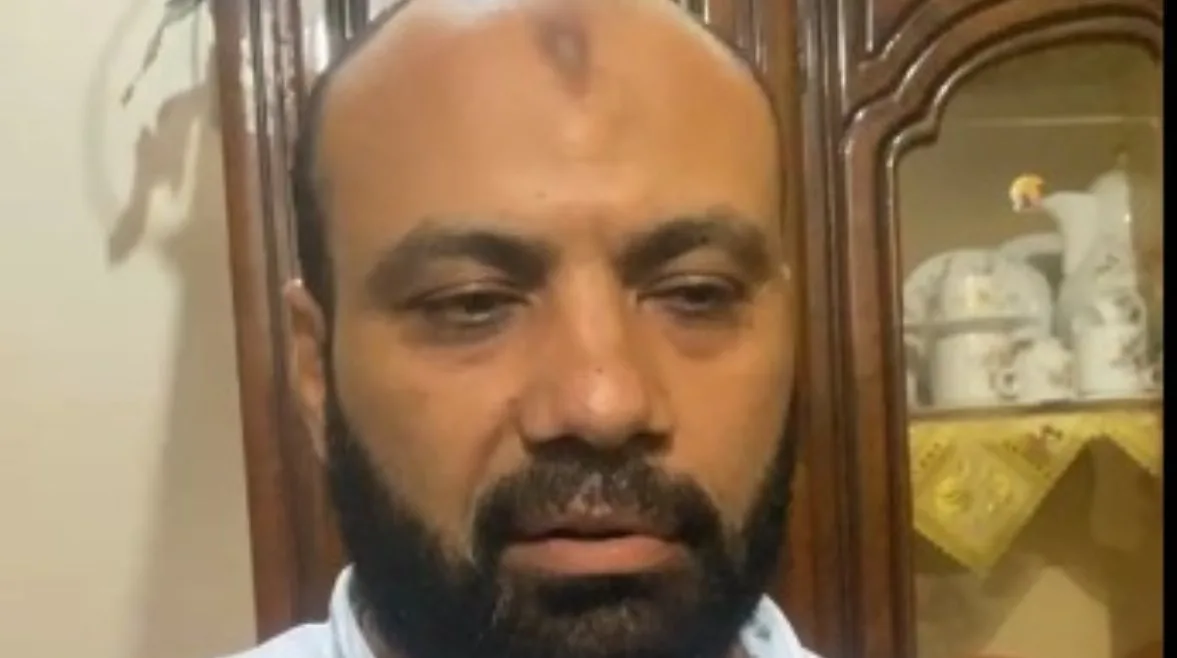 إزالة الطحال وبدء التنفس الاصطناعي: أحدث المستجدات حول صحة الناجيات من الحادث الإقليمي (فيديو) إزالة الطحال وبدء التنفس الاصطناعي: أحدث المستجدات حول صحة الناجيات من الحادث الإقليمي (فيديو)