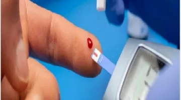استشاري يقدم شرحًا لأحدث أساليب تشخيص مرحلة ما قبل السكري