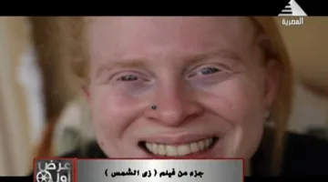 “ال première” تستعرض فيلم “زي الشمس” الذي يتناول قصة المصابين بالمهق