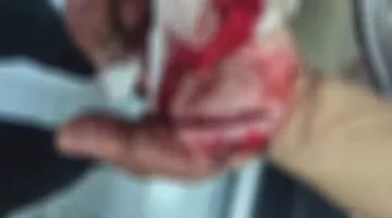 النيابة تبدأ التحقيق في حادث اعتداء متهم خطير على موظف في حلوان