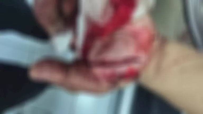 النيابة تبدأ التحقيق في حادث اعتداء متهم خطير على موظف في حلوان النيابة تبدأ التحقيق في حادث اعتداء متهم خطير على موظف في حلوان