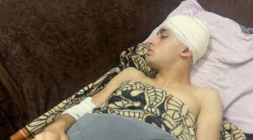 حلاق يوجه تهمة لـ “صوفينار” بالتسبب في إعاقته الدائمة في السيدة زينب (فيديو)