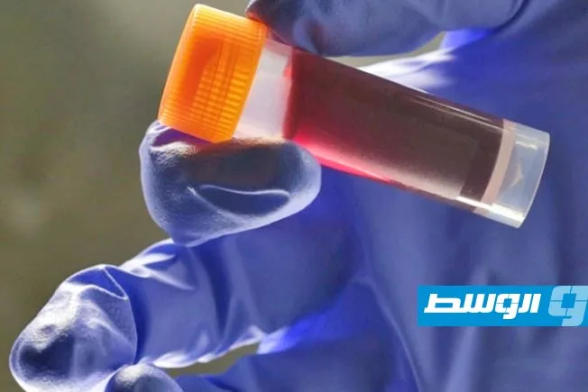 دراسة تكشف عن فصيلة الدم الأكثر قابلية للإصابة بالسكتة الدماغية في سن مبكرة. دراسة تكشف عن فصيلة الدم الأكثر قابلية للإصابة بالسكتة الدماغية في سن مبكرة.