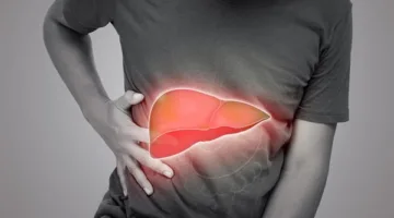 دهون الكبد: الأعراض، التشخيص، ووسائل العلاج والوقاية