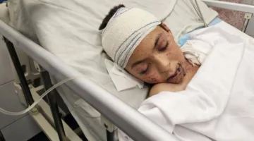 طفل فلسطيني فقد 9 من إخوته جراء غارة إسرائيلية يتلقى العلاج في إيطاليا