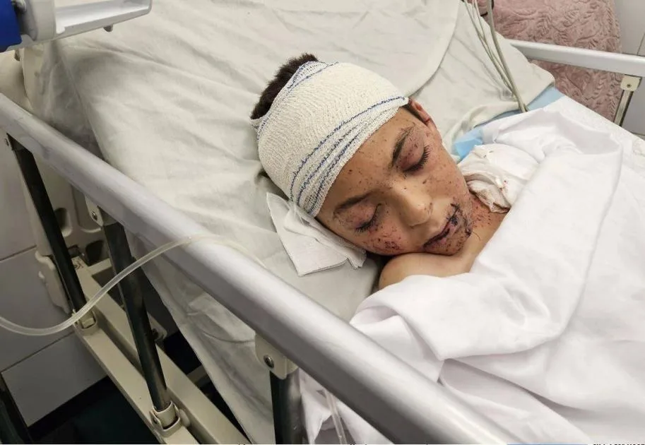 طفل فلسطيني فقد 9 من إخوته جراء غارة إسرائيلية يتلقى العلاج في إيطاليا طفل فلسطيني فقد 9 من إخوته جراء غارة إسرائيلية يتلقى العلاج في إيطاليا