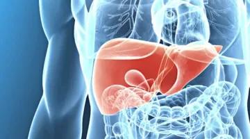 عشقها الكثيرون… 3 أطعمة تسبب 3 أمراض خطيرة للكبد