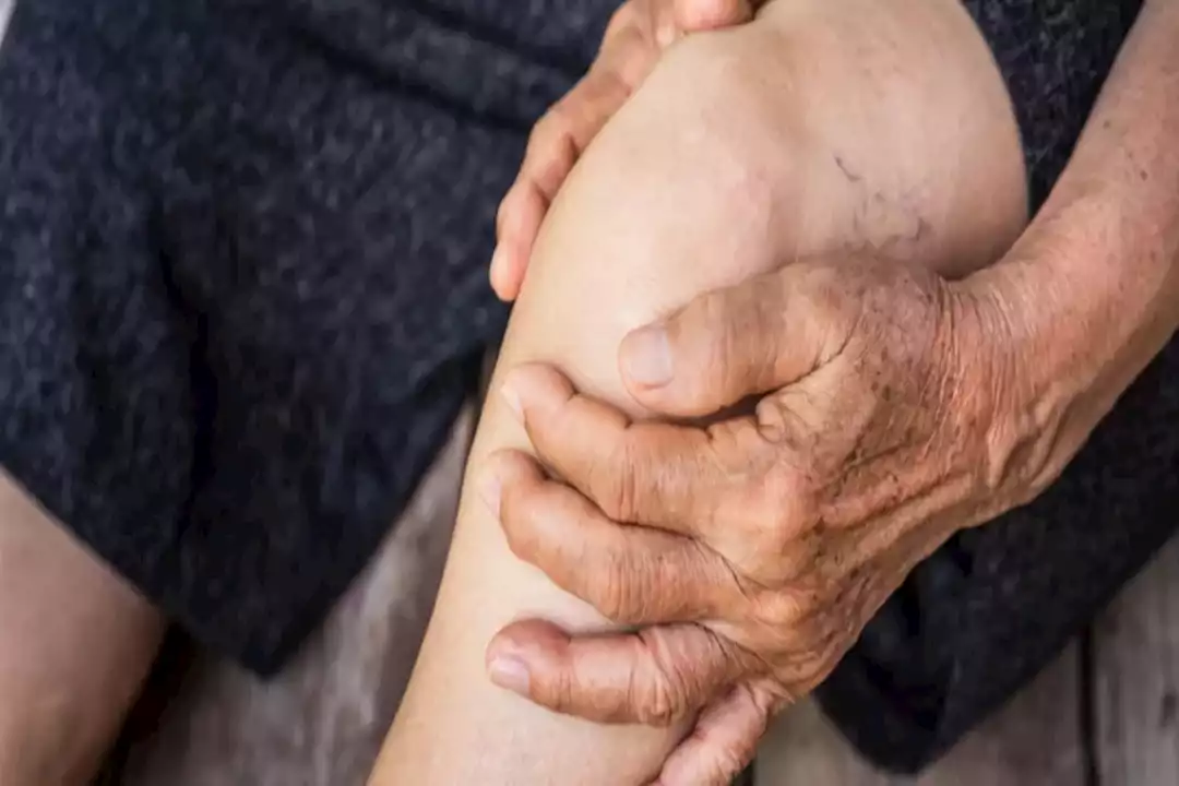 علاج فعّال وآمن: دعامات الركبة الخيار الأمثل لالتهاب المفاصل علاج فعّال وآمن: دعامات الركبة الخيار الأمثل لالتهاب المفاصل