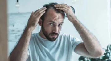 علاج مبتكر باستخدام الخلايا الجذعية يعزز نمو الشعر