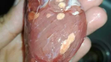 كيف تحمي نفسك من “حروق التجميد”؟.. أخطاء شائعة في تخزين اللحوم تحذر منها الإرشادات البيطرية