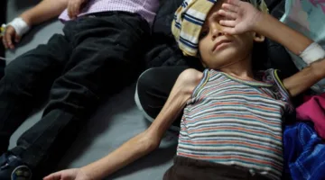 برنامج الأغذية العالمي: 70 ألف طفل في غزة يواجهون نقص التغذية