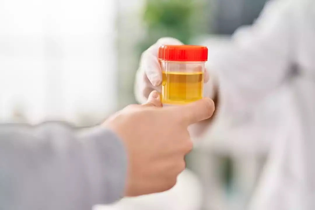 مشكلة في البول تتطلب زيارة الطبيب فوراً.. كن حذراً! مشكلة في البول تتطلب زيارة الطبيب فوراً.. كن حذراً!