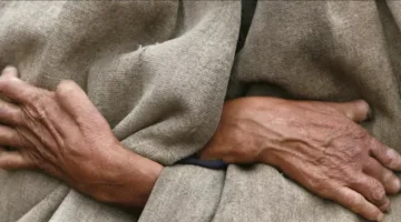 مصر تسعى للقضاء على مرض خطير.. ما هذا المرض؟