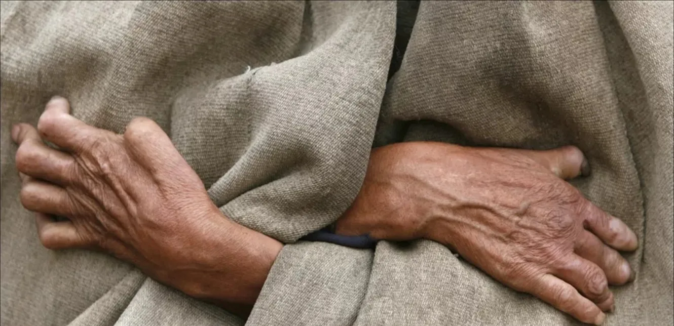 مصر تسعى للقضاء على مرض خطير.. ما هذا المرض؟ مصر تسعى للقضاء على مرض خطير.. ما هذا المرض؟