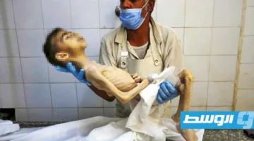 موت طفلين جوعًا نتيجة الحصار الإسرائيلي على غزة
