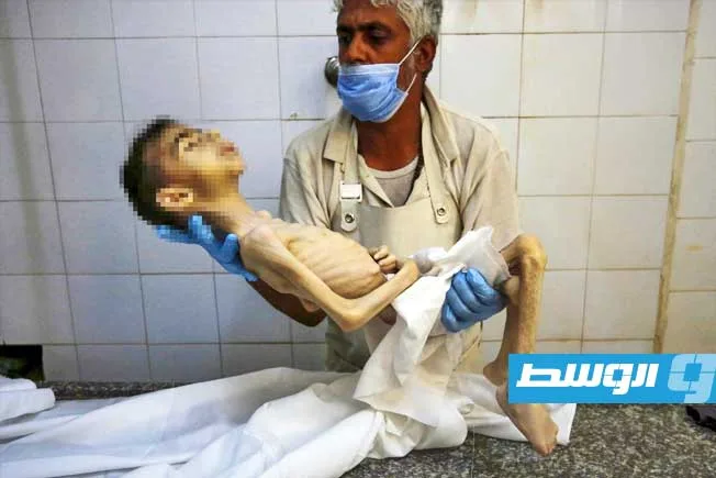 موت طفلين جوعًا نتيجة الحصار الإسرائيلي على غزة
