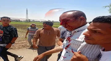 نقدم تقريراً طبياً عن مدير حماية الأراضي الذي تعرض للاعتداء خلال الحملة في سوهاج.