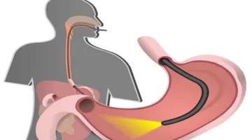 أفضل اللحظات لتعزيز صحة الهضم