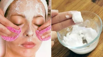 طرق طبيعية لإزالة البقع الداكنة من البشرة.. ضرورية في الصيف