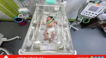 “الأونروا” تنبه إلى ارتفاع حالات الولادة المبكرة ومضاعفات غير معتادة للأطفال المبتسرين في قطاع غزة