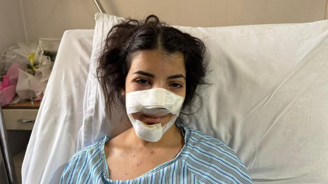 امرأة شابة ذات شعر داكن وضمادات حول وجهها تجلس على سرير المستشفى