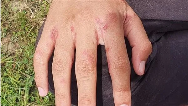 زوار الشواطئ يواجهون مخاطر كبيرة نتيجة لخطأ شائع