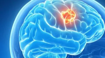 3 أنواع من التمارين التي تدعم صحة الدماغ
