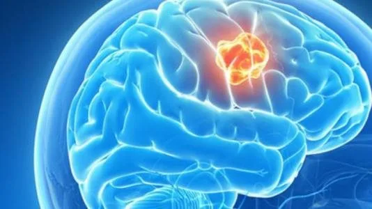 3 أنواع من التمارين التي تدعم صحة الدماغ 3 أنواع من التمارين التي تدعم صحة الدماغ